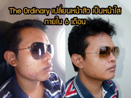 The Ordinary เปลี่ยนหน้าสิว เป็นหน้าใส